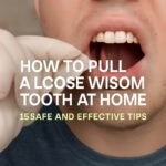 how to pull a loose wisdom tooth at home