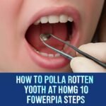 how to pull a rotten tooth at home